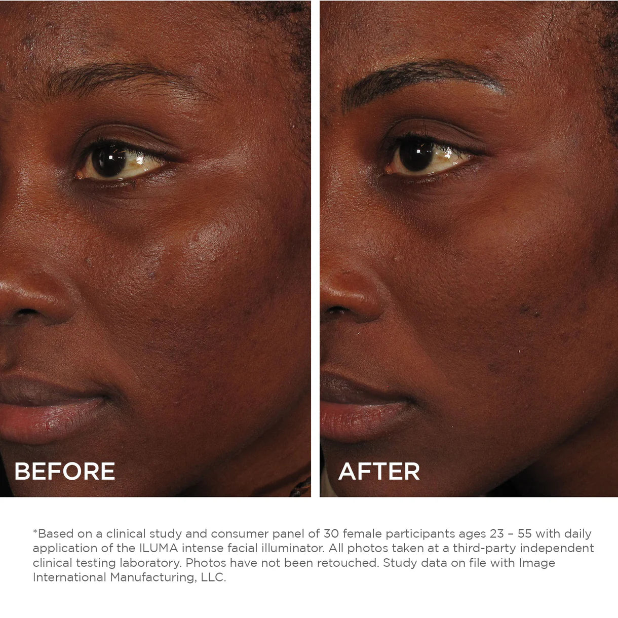 Image ILUMA Intense Facial Illuminator