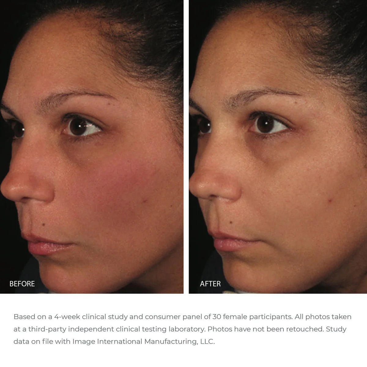 Image ORMEDIC balancing antioxidant serum