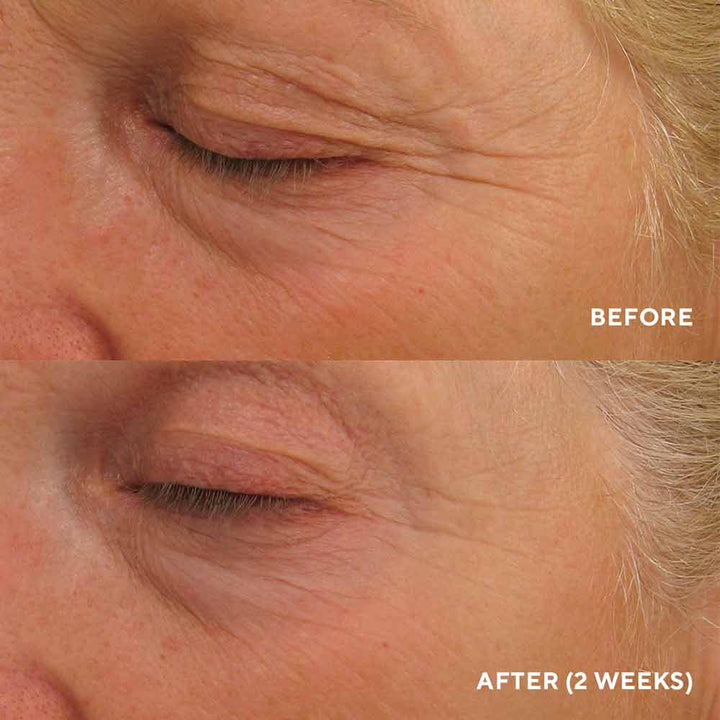 Eye Authority – Hydropeptide