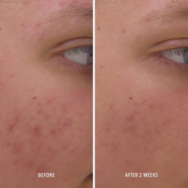 HydroPeptide Clear Rescue Skin Refining Serum