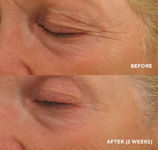 HYDROPEPTIDE EYE REVIVE