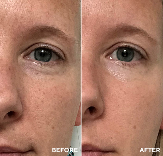 Anti-Wrinkle Polish & Plump Peel