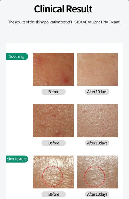 Azulene DNA cream