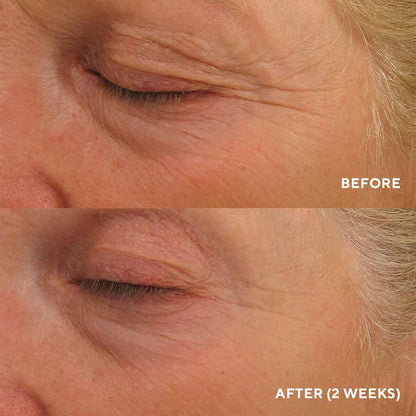 Eye Authority – Hydropeptide