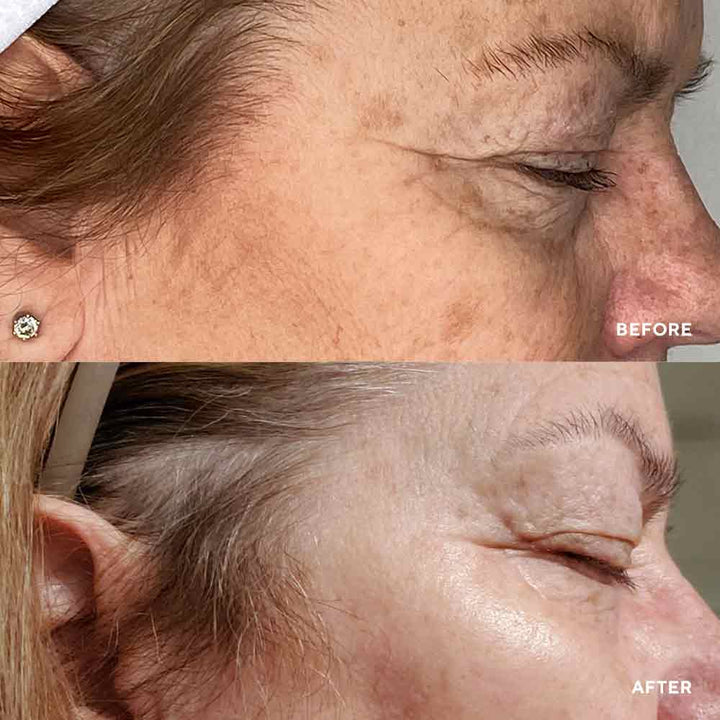 Vital Eyes Hydropeptide